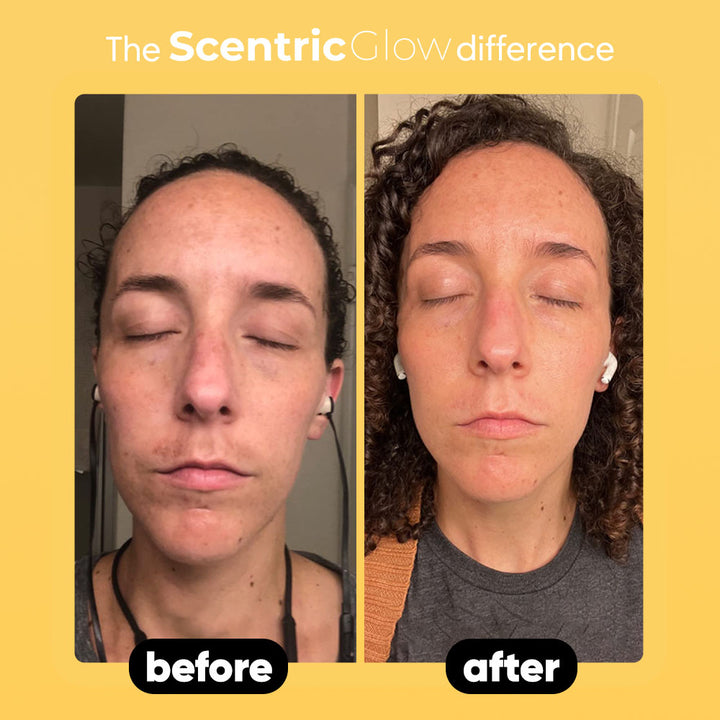 lemon turmeric & kojic acid soap